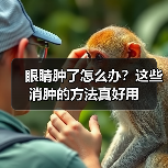 眼睛肿了怎么办?这些消肿的方法真好用(图4) 眼睛肿了怎么办?这些消肿的方法真好用(图4)