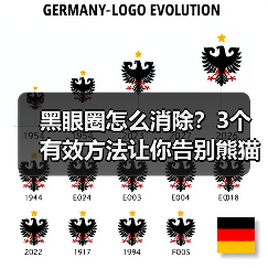 黑眼圈怎么消除？3个有效方法让你告别熊猫